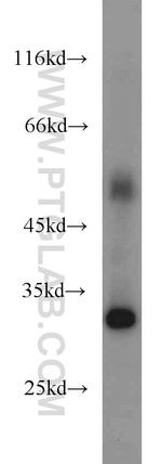 ASB8 Antibody in Western Blot (WB)