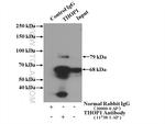 THOP1 Antibody in Immunoprecipitation (IP)