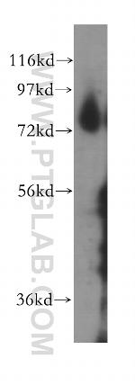 THOP1 Antibody in Western Blot (WB)