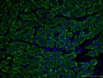 ASGR1 Antibody in Immunohistochemistry (PFA fixed) (IHC (PFA))