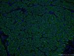 ASGR1 Antibody in Immunohistochemistry (PFA fixed) (IHC (PFA))