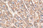 ASGR1 Antibody in Immunohistochemistry (Paraffin) (IHC (P))