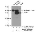 ASGR1 Antibody in Immunoprecipitation (IP)