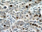 TPX2 Antibody in Immunohistochemistry (Paraffin) (IHC (P))