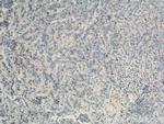 TPX2 Antibody in Immunohistochemistry (Paraffin) (IHC (P))