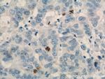 TPX2 Antibody in Immunohistochemistry (Paraffin) (IHC (P))