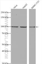 TPX2 Antibody in Western Blot (WB)
