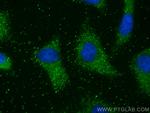 PKIA Antibody in Immunocytochemistry (ICC/IF)