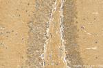 PKIA Antibody in Immunohistochemistry (Paraffin) (IHC (P))