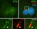 IFT81 Antibody in Immunocytochemistry (ICC/IF)