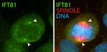 IFT81 Antibody in Immunocytochemistry (ICC/IF)