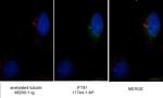 IFT81 Antibody in Immunocytochemistry (ICC/IF)