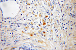 IFT81 Antibody in Immunohistochemistry (Paraffin) (IHC (P))