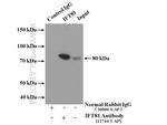 IFT81 Antibody in Immunoprecipitation (IP)