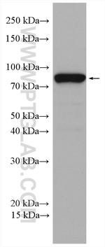 IFT81 Antibody in Western Blot (WB)