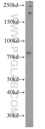 IFT81 Antibody in Western Blot (WB)