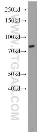 IFT81 Antibody in Western Blot (WB)
