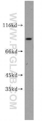 IFT81 Antibody in Western Blot (WB)
