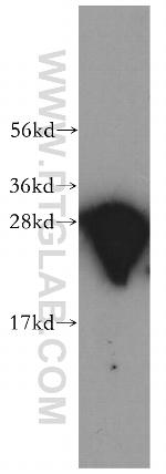 CACYBP Antibody in Western Blot (WB)