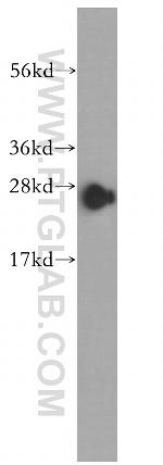 CACYBP Antibody in Western Blot (WB)