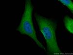 CACYBP Antibody in Immunocytochemistry (ICC/IF)