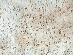 CACYBP Antibody in Immunohistochemistry (Paraffin) (IHC (P))