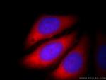 CACYBP Antibody in Immunocytochemistry (ICC/IF)