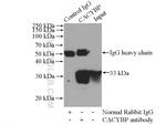 CACYBP Antibody in Immunoprecipitation (IP)