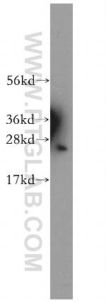 PSMB1 Antibody in Western Blot (WB)