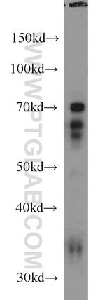 NFIA Antibody in Western Blot (WB)