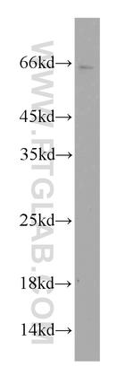 TWIST2 Antibody in Western Blot (WB)