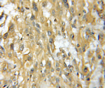 TMOD4 Antibody in Immunohistochemistry (Paraffin) (IHC (P))