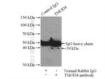 TMOD4 Antibody in Immunoprecipitation (IP)