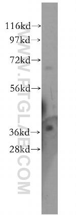 TMOD4 Antibody in Western Blot (WB)