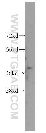 TMOD4 Antibody in Western Blot (WB)