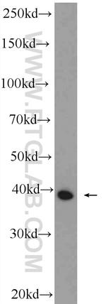 TMOD4 Antibody in Western Blot (WB)
