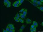 FKBP3 Antibody in Immunocytochemistry (ICC/IF)
