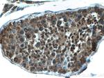 FKBP3 Antibody in Immunohistochemistry (Paraffin) (IHC (P))
