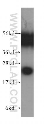 RAB2B Antibody in Western Blot (WB)