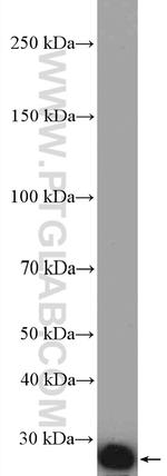 RAB2B Antibody in Western Blot (WB)