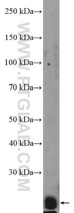 RAB2B Antibody in Western Blot (WB)
