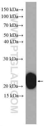 RAB2B Antibody in Western Blot (WB)