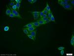 ZNF395 Antibody in Immunocytochemistry (ICC/IF)