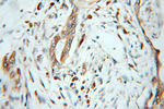 ZNF395 Antibody in Immunohistochemistry (Paraffin) (IHC (P))