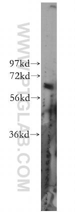 ZNF395 Antibody in Western Blot (WB)