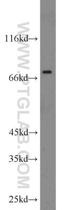 ZNF395 Antibody in Western Blot (WB)