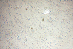 NUDCD3 Antibody in Immunohistochemistry (Paraffin) (IHC (P))