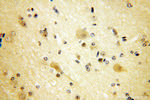 NUDCD3 Antibody in Immunohistochemistry (Paraffin) (IHC (P))