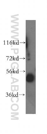 NUDCD3 Antibody in Western Blot (WB)