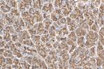 CLPS Antibody in Immunohistochemistry (Paraffin) (IHC (P))